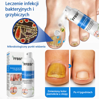 Szybka ulga w swędzeniu i ukojenie zaczerwienionej skóry! ⭐FFBSI® Magnezowy spray ziołowy na łuszczycę 🔥Łagodzi objawy łuszczycy, egzemy i trądziku, zmniejsza wypryski i przebarwienia, głęboko nawilża i wspiera regenerację skóry