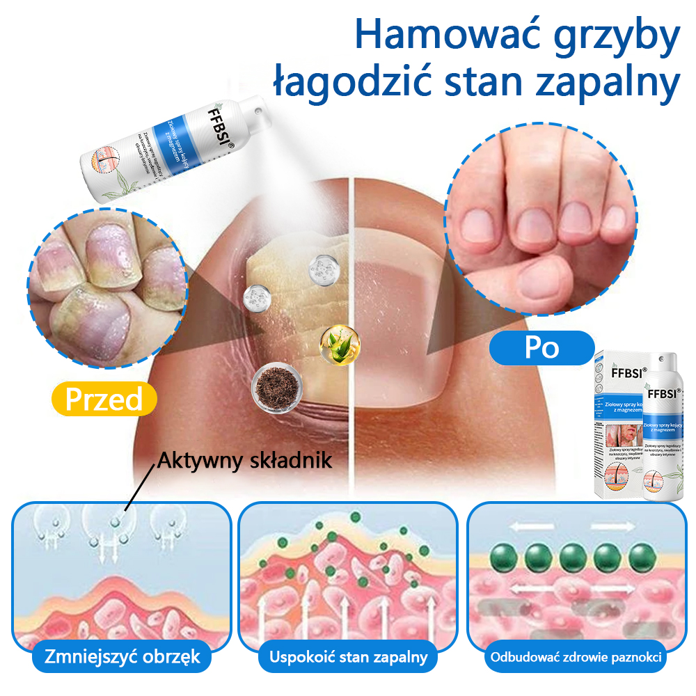 Szybka ulga w swędzeniu i ukojenie zaczerwienionej skóry! ⭐FFBSI® Magnezowy spray ziołowy na łuszczycę 🔥Łagodzi objawy łuszczycy, egzemy i trądziku, zmniejsza wypryski i przebarwienia, głęboko nawilża i wspiera regenerację skóry