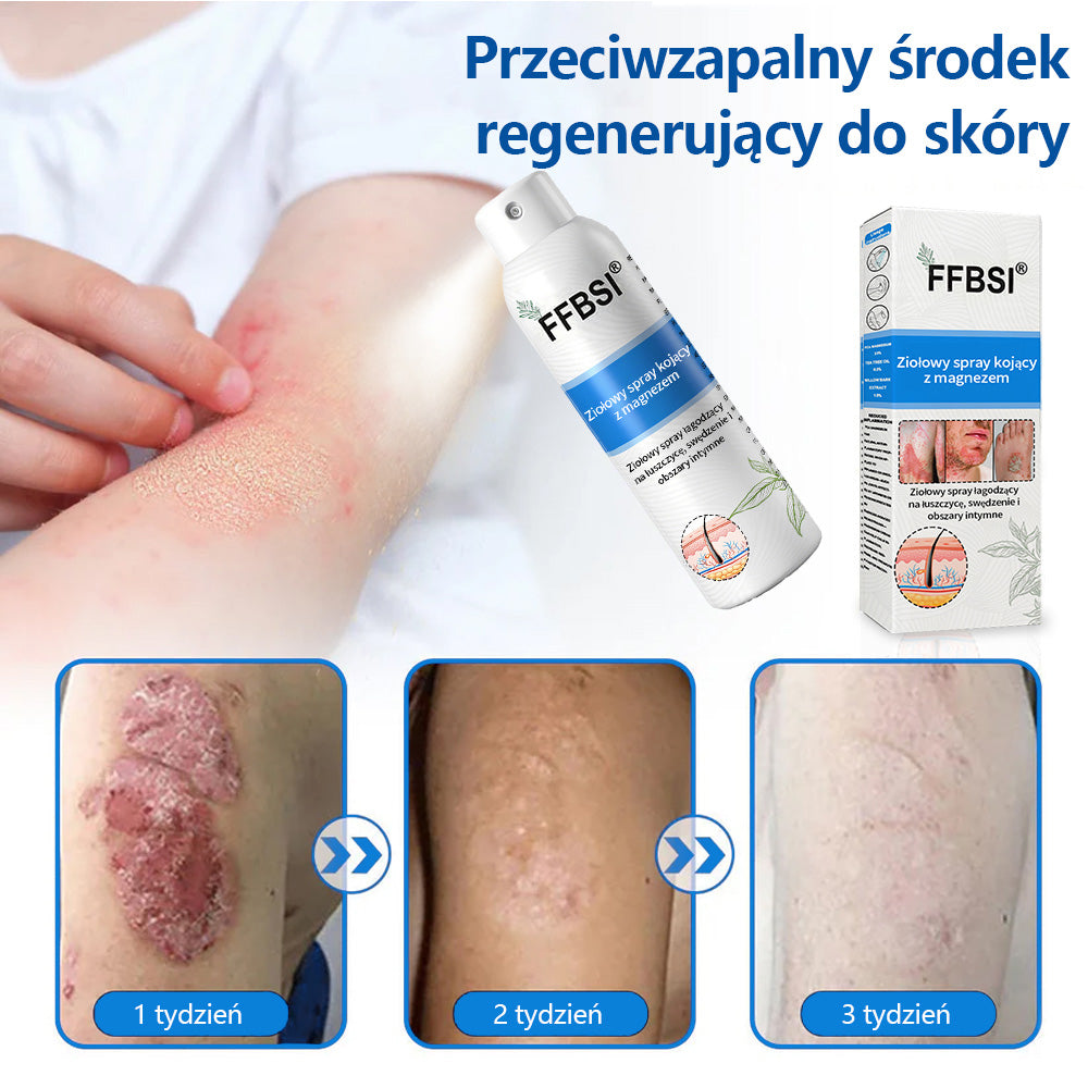 Szybka ulga w swędzeniu i ukojenie zaczerwienionej skóry! ⭐FFBSI® Magnezowy spray ziołowy na łuszczycę 🔥Łagodzi objawy łuszczycy, egzemy i trądziku, zmniejsza wypryski i przebarwienia, głęboko nawilża i wspiera regenerację skóry