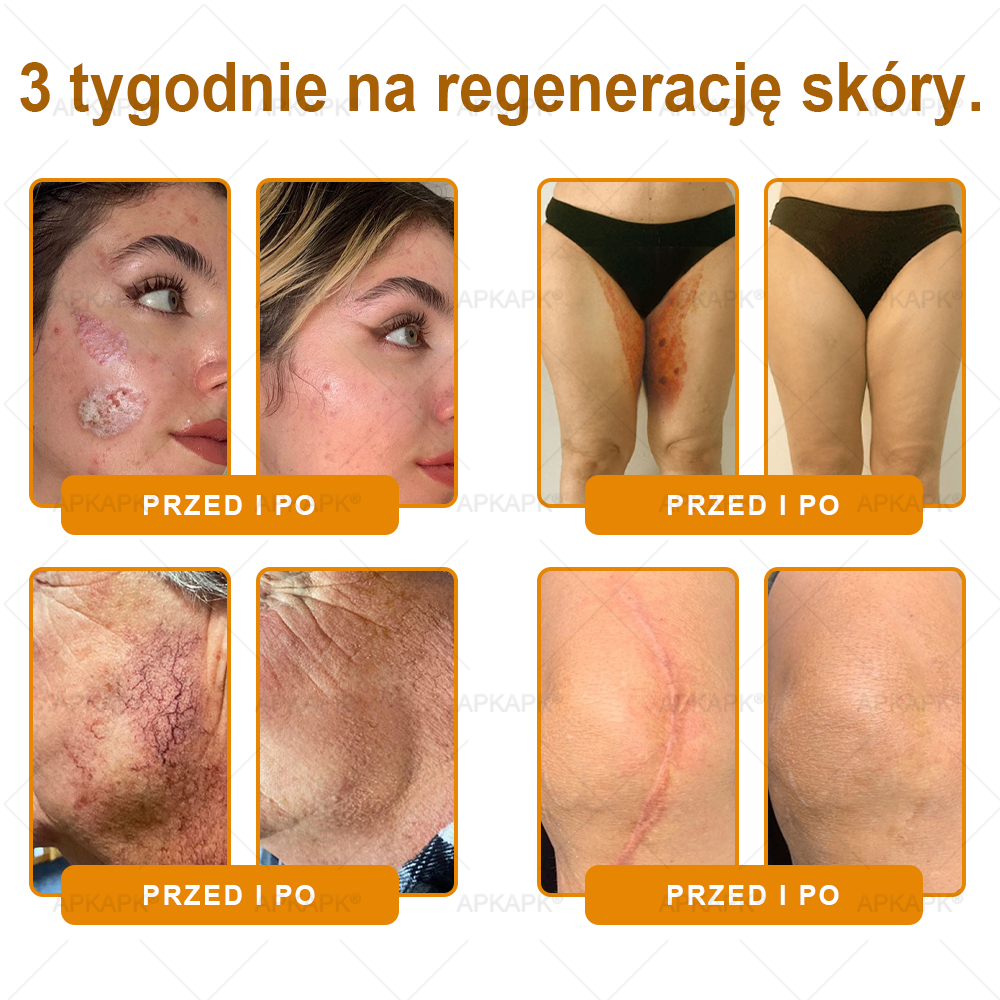 ΑPΚΑPK® Jad Pszczoły Kompleksowy Krem✨✨pomaga w leczeniu problemów skórnych, takich jak: zmarszczki, blizny, plamy pigmentacyjne, rozstępy, trądzik, łuszczyca, egzema, zmiany skórne, podrażnienia, stany zapalne i inne problemy skórne🔥