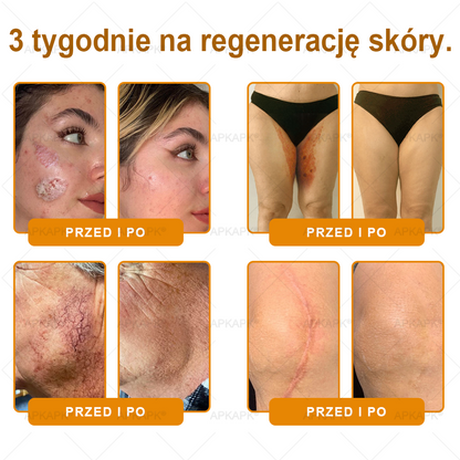 ΑPΚΑPK® Jad Pszczoły Kompleksowy Krem✨✨pomaga w leczeniu problemów skórnych, takich jak: zmarszczki, blizny, plamy pigmentacyjne, rozstępy, trądzik, łuszczyca, egzema, zmiany skórne, podrażnienia, stany zapalne i inne problemy skórne🔥