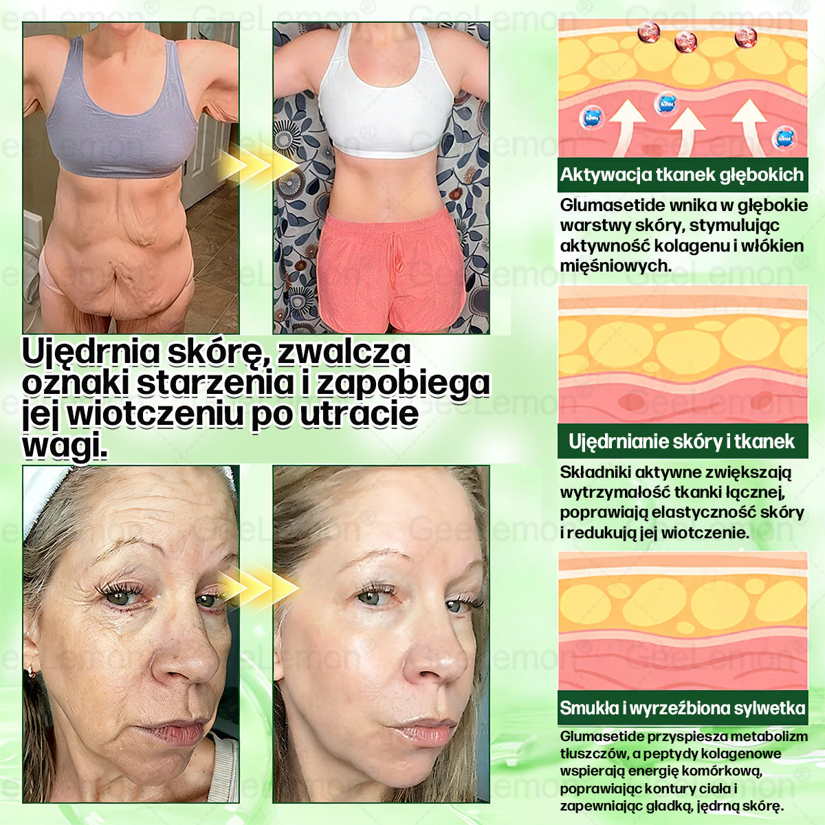 Oficjalny Sklep | 👩‍⚕️🛡️ 𝐆𝐞𝑒𝐿𝑒𝐦𝐨𝐧® 𝐆𝐥𝐮𝐦ase𝐭𝐢𝐝𝐞 𝟖 𝐰 𝟏 Smukły i Zdrowy Nano Plaster z Mikronakłuciami 🇵🇱(Tylko raz dziennie, widoczne zmiany już w 7 dni)✅ Na otyłość, 🅛🅞🅞🅢🅔 🅢🅚🅘🅝 wiotką skórę, cukrzycę, bezdech senny, problemy ze stawami i wiele więcej