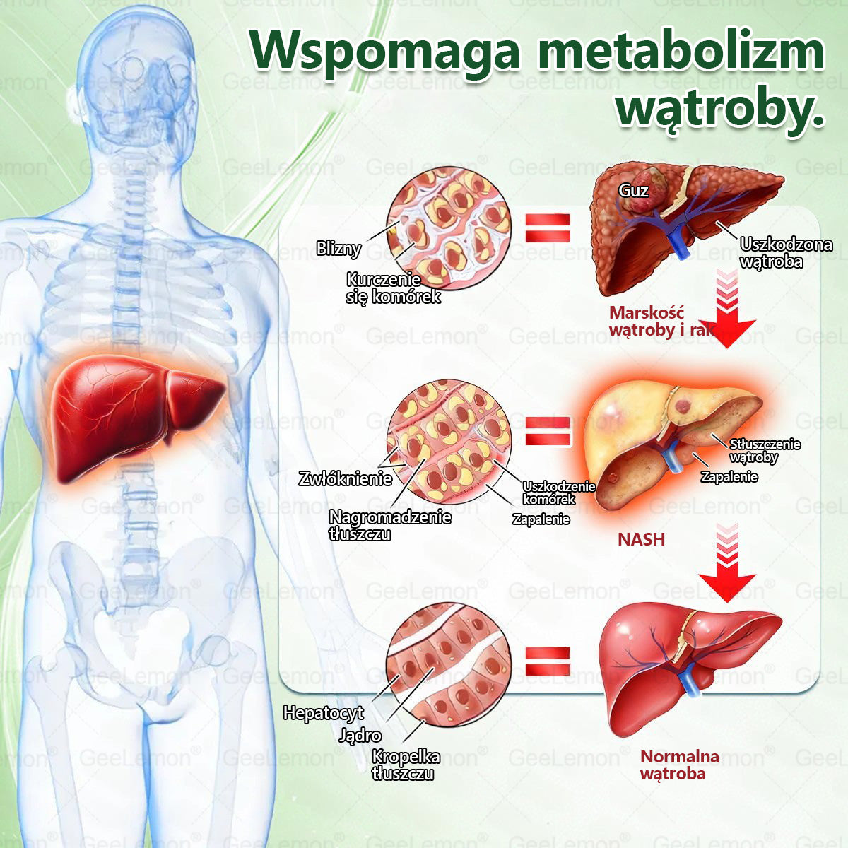 Oficjalny Sklep | 👩‍⚕️🛡️ 𝐆𝐞𝑒𝐿𝑒𝐦𝐨𝐧® 𝐆𝐥𝐮𝐦ase𝐭𝐢𝐝𝐞 𝟖 𝐰 𝟏 Smukły i Zdrowy Nano Plaster z Mikronakłuciami 🇵🇱(Tylko raz dziennie, widoczne zmiany już w 7 dni)✅ Na otyłość, 🅛🅞🅞🅢🅔 🅢🅚🅘🅝 wiotką skórę, cukrzycę, bezdech senny, problemy ze stawami i wiele więcej