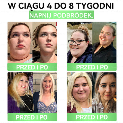 Oficjalny Sklep | 👩‍⚕️🛡️ 𝐆𝐞𝑒𝐿𝑒𝐦𝐨𝐧® 𝐆𝐥𝐮𝐦ase𝐭𝐢𝐝𝐞 𝟖 𝐰 𝟏 Smukły i Zdrowy Nano Plaster z Mikronakłuciami 🇵🇱(Tylko raz dziennie, widoczne zmiany już w 7 dni)✅ Na otyłość, 🅛🅞🅞🅢🅔 🅢🅚🅘🅝 wiotką skórę, cukrzycę, bezdech senny, problemy ze stawami i wiele więcej