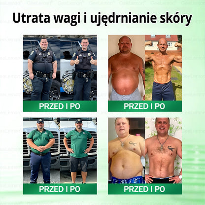 Oficjalny Sklep | 👩‍⚕️🛡️ 𝐆𝐞𝑒𝐿𝑒𝐦𝐨𝐧® 𝐆𝐥𝐮𝐦ase𝐭𝐢𝐝𝐞 𝟖 𝐰 𝟏 Smukły i Zdrowy Nano Plaster z Mikronakłuciami 🇵🇱(Tylko raz dziennie, widoczne zmiany już w 7 dni)✅ Na otyłość, 🅛🅞🅞🅢🅔 🅢🅚🅘🅝 wiotką skórę, cukrzycę, bezdech senny, problemy ze stawami i wiele więcej