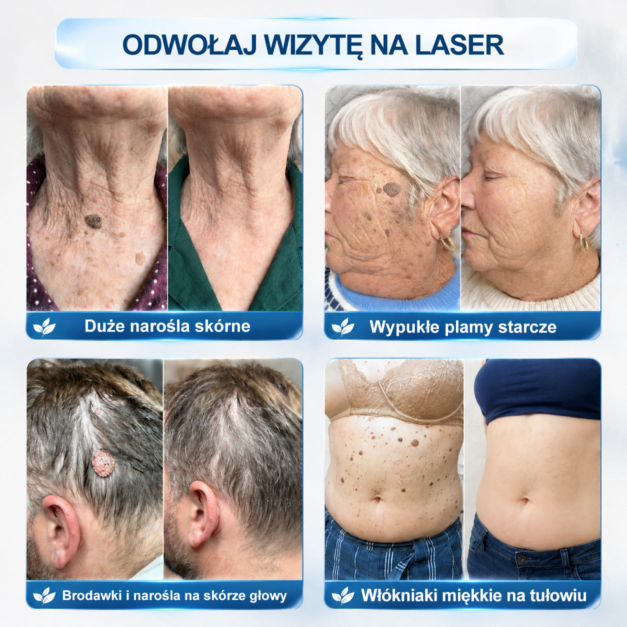 🍀🍀👑Hiskin® 7 𝑫𝒏𝒊 𝑷𝒓𝒆𝒑𝒂𝒓𝒂𝒕 𝑫𝒐 𝑼𝒔𝒖𝒘𝒂𝒏𝒊𝒂 𝑾łó𝒌𝒏𝒊𝒂𝒌ó𝒘 𝑴𝒊ę𝒌𝒌𝒊𝒄𝒉 𝑰 𝑷𝒓𝒛𝒆𝒃𝒂𝒓𝒘𝒊𝒆ń(𝐁𝐞𝐳 𝐁ó𝐥𝐮, 𝐁𝐞𝐳 𝐁𝐥𝐢𝐳𝐧 – 𝐑𝐨𝐥𝐥-𝐨𝐧)