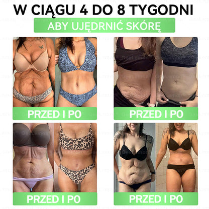 Oficjalny Sklep | 👩‍⚕️🛡️ 𝐆𝐞𝑒𝐿𝑒𝐦𝐨𝐧® 𝐆𝐥𝐮𝐦ase𝐭𝐢𝐝𝐞 𝟖 𝐰 𝟏 Smukły i Zdrowy Nano Plaster z Mikronakłuciami 🇵🇱(Tylko raz dziennie, widoczne zmiany już w 7 dni)✅ Na otyłość, 🅛🅞🅞🅢🅔 🅢🅚🅘🅝 wiotką skórę, cukrzycę, bezdech senny, problemy ze stawami i wiele więcej