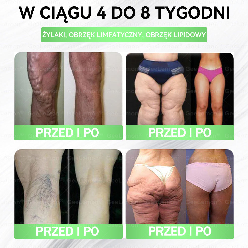 Oficjalny Sklep | 👩‍⚕️🛡️ 𝐆𝐞𝑒𝐿𝑒𝐦𝐨𝐧® 𝐆𝐥𝐮𝐦ase𝐭𝐢𝐝𝐞 𝟖 𝐰 𝟏 Smukły i Zdrowy Nano Plaster z Mikronakłuciami 🇵🇱(Tylko raz dziennie, widoczne zmiany już w 7 dni)✅ Na otyłość, 🅛🅞🅞🅢🅔 🅢🅚🅘🅝 wiotką skórę, cukrzycę, bezdech senny, problemy ze stawami i wiele więcej