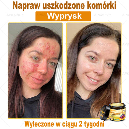 🔥🔥 Zostały tylko 5 okazji! Teraz skorzystaj z dodatkowej 50% zniżki! Zadbaj o zdrowie swojego ciała! Jeśli przegapisz tę okazję, będziesz musiał czekać do przyszłego roku — APKAPK