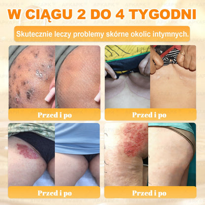 ΑPΚΑPK® Jad Pszczoły Kompleksowy Krem✨✨pomaga w leczeniu problemów skórnych, takich jak: zmarszczki, blizny, plamy pigmentacyjne, rozstępy, trądzik, łuszczyca, egzema, zmiany skórne, podrażnienia, stany zapalne i inne problemy skórne🔥