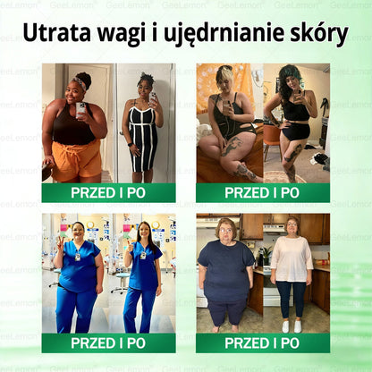 Oficjalny Sklep | 👩‍⚕️🛡️ 𝐆𝐞𝑒𝐿𝑒𝐦𝐨𝐧® 𝐆𝐥𝐮𝐦ase𝐭𝐢𝐝𝐞 𝟖 𝐰 𝟏 Smukły i Zdrowy Nano Plaster z Mikronakłuciami 🇵🇱(Tylko raz dziennie, widoczne zmiany już w 7 dni)✅ Na otyłość, 🅛🅞🅞🅢🅔 🅢🅚🅘🅝 wiotką skórę, cukrzycę, bezdech senny, problemy ze stawami i wiele więcej