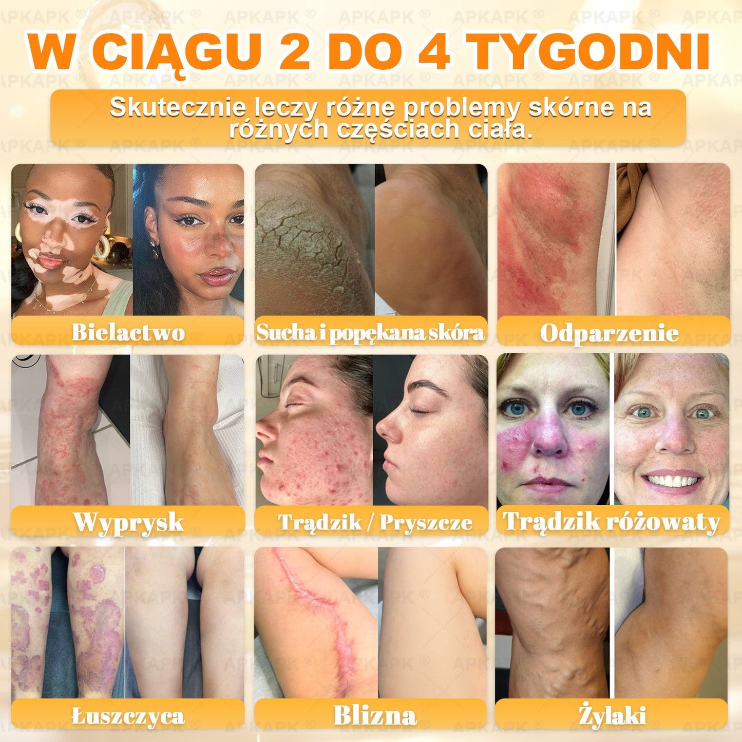 ΑPΚΑPK® Jad Pszczoły Kompleksowy Krem✨✨pomaga w leczeniu problemów skórnych, takich jak: zmarszczki, blizny, plamy pigmentacyjne, rozstępy, trądzik, łuszczyca, egzema, zmiany skórne, podrażnienia, stany zapalne i inne problemy skórne🔥