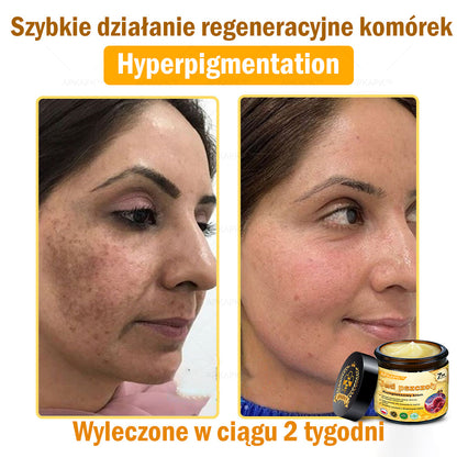 🔥🔥 Zostały tylko 5 okazji! Teraz skorzystaj z dodatkowej 50% zniżki! Zadbaj o zdrowie swojego ciała! Jeśli przegapisz tę okazję, będziesz musiał czekać do przyszłego roku — APKAPK