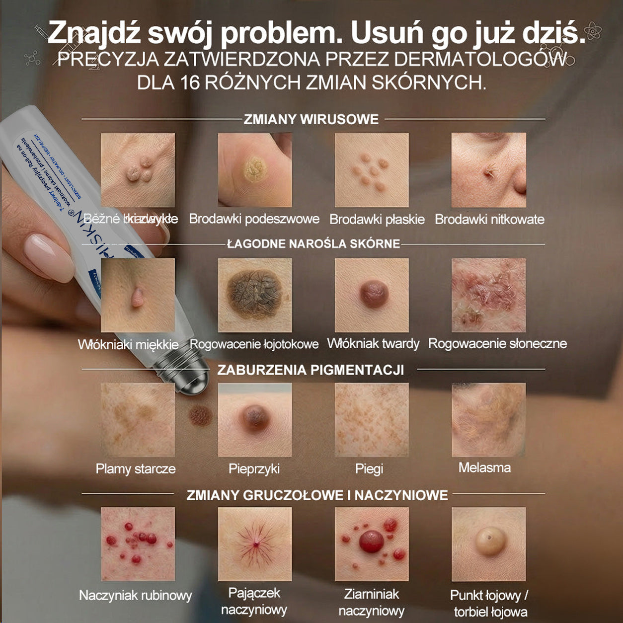 🍀🍀👑Hiskin® 7 𝑫𝒏𝒊 𝑷𝒓𝒆𝒑𝒂𝒓𝒂𝒕 𝑫𝒐 𝑼𝒔𝒖𝒘𝒂𝒏𝒊𝒂 𝑾łó𝒌𝒏𝒊𝒂𝒌ó𝒘 𝑴𝒊ę𝒌𝒌𝒊𝒄𝒉 𝑰 𝑷𝒓𝒛𝒆𝒃𝒂𝒓𝒘𝒊𝒆ń(𝐁𝐞𝐳 𝐁ó𝐥𝐮, 𝐁𝐞𝐳 𝐁𝐥𝐢𝐳𝐧 – 𝐑𝐨𝐥𝐥-𝐨𝐧)