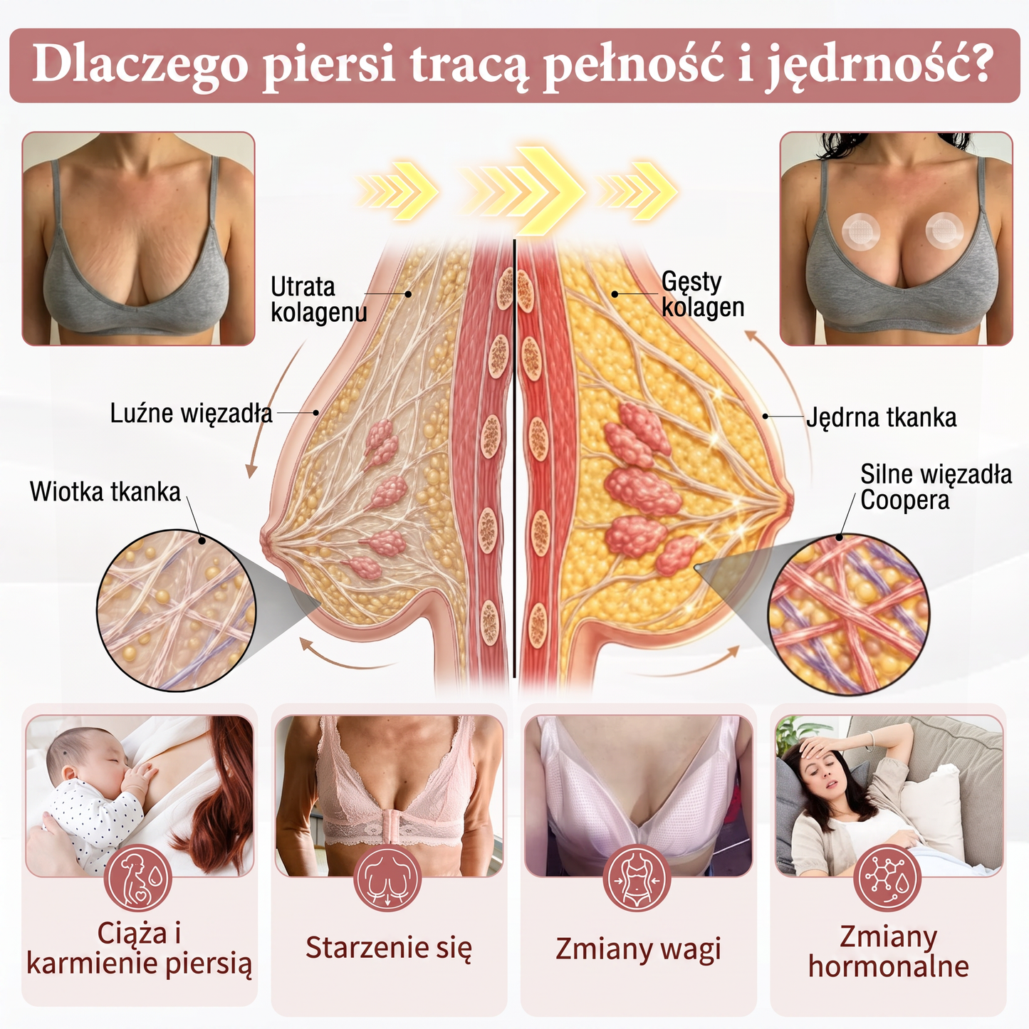 💜HISKIN® Mikroigłowe plastry na piersi wspierające efekt pełniejszego wyglądu, liftingu i ujędrnienia
