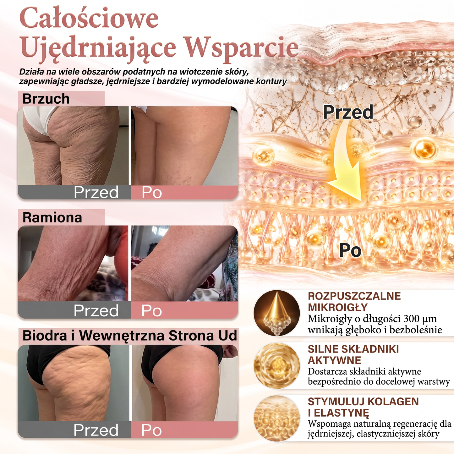 💜HISKIN® Mikroigłowe plastry na piersi wspierające efekt pełniejszego wyglądu, liftingu i ujędrnienia