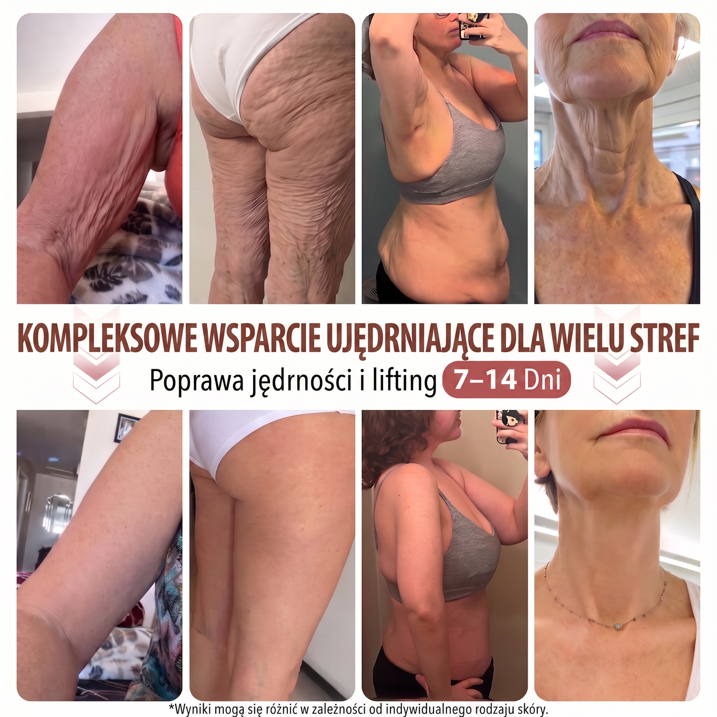 💜HISKIN® Mikroigłowe plastry na piersi wspierające efekt pełniejszego wyglądu, liftingu i ujędrnienia